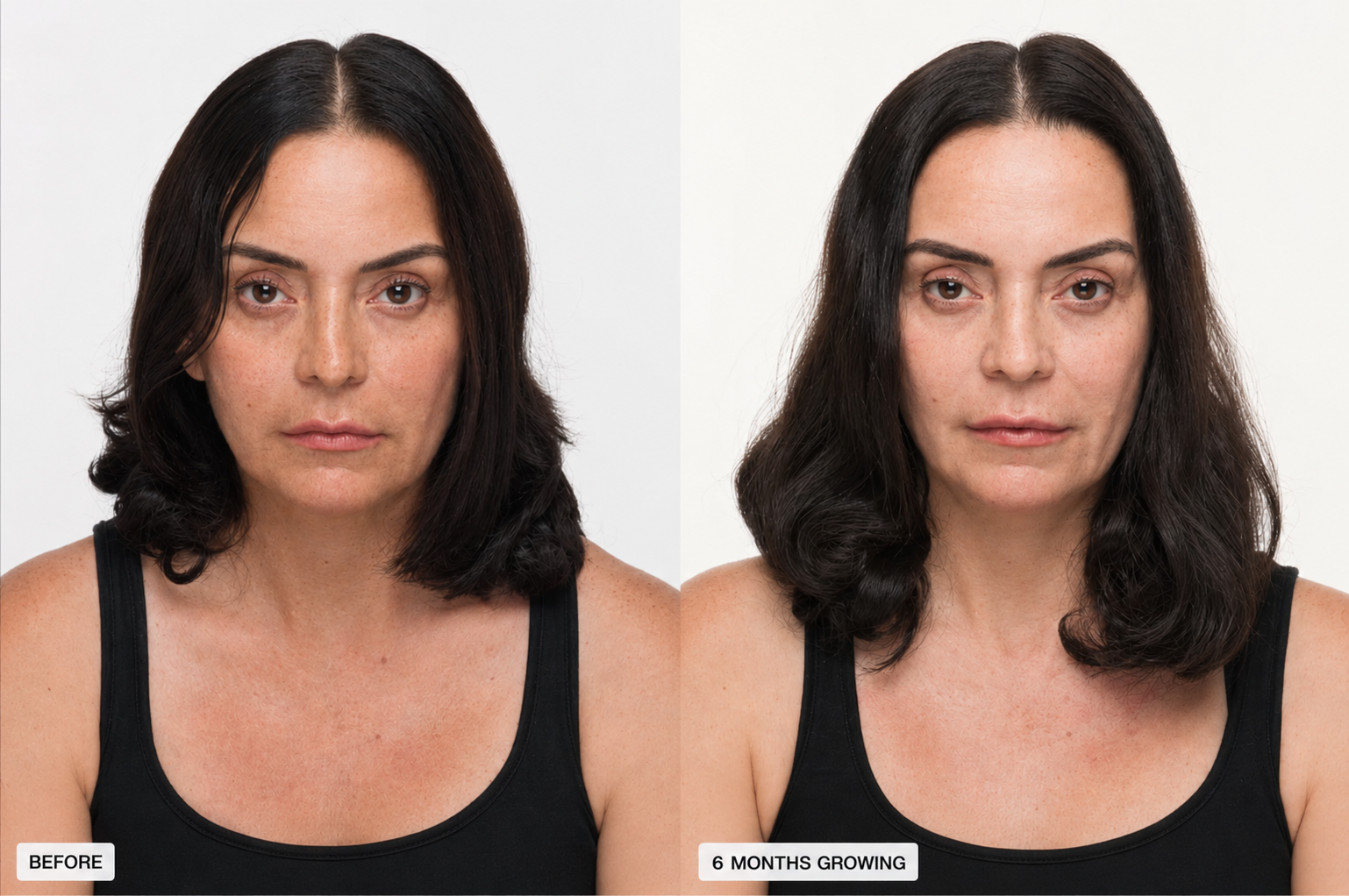 Nutrafol Before and After Kimberly