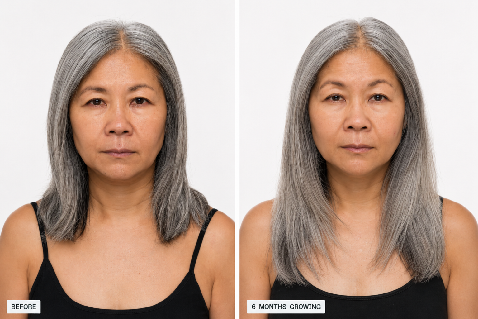 Nutrafol Before and After Maria