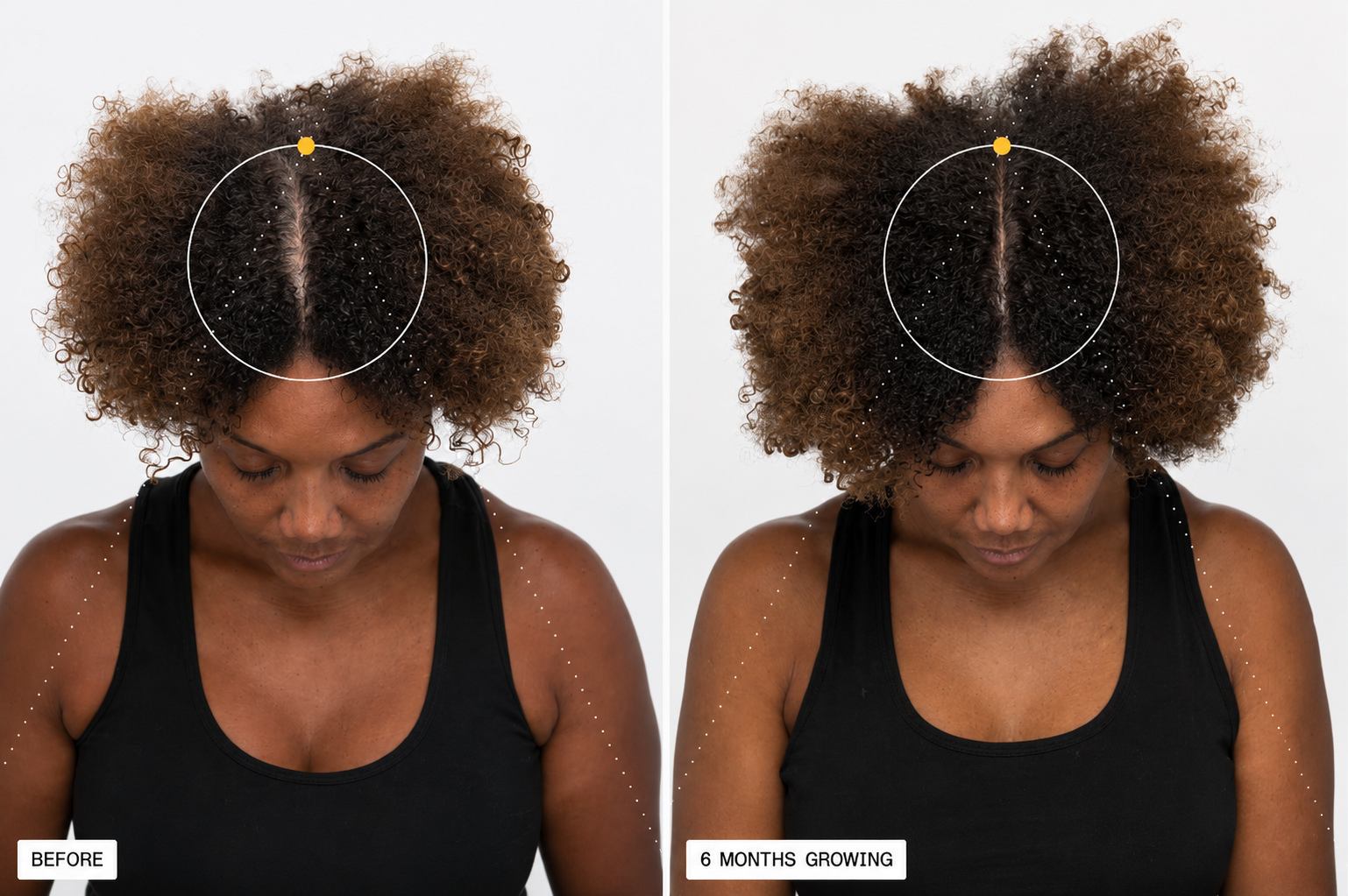 Nutrafol Before and After Linda