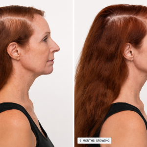 Nutrafol Women's Balance Hair Growth - Image 2